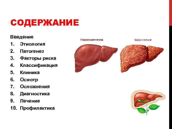 СОДЕРЖАНИЕ Введение 1. Этиология 2. Патогенез 3. Факторы риска 4. Классификация 5. Клиника 6.