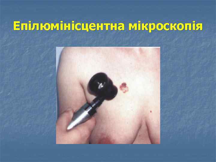 Епілюмінісцентна мікроскопія 