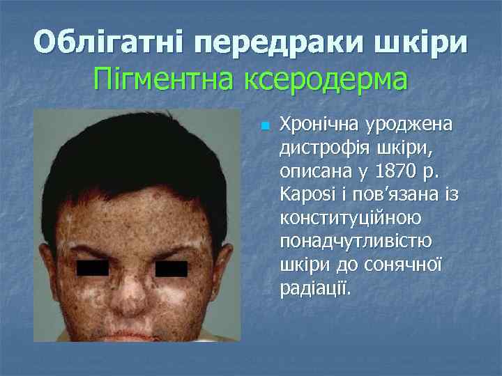 Облігатні передраки шкіри Пігментна ксеродерма n Хронічна уроджена дистрофія шкіри, описана у 1870 р.