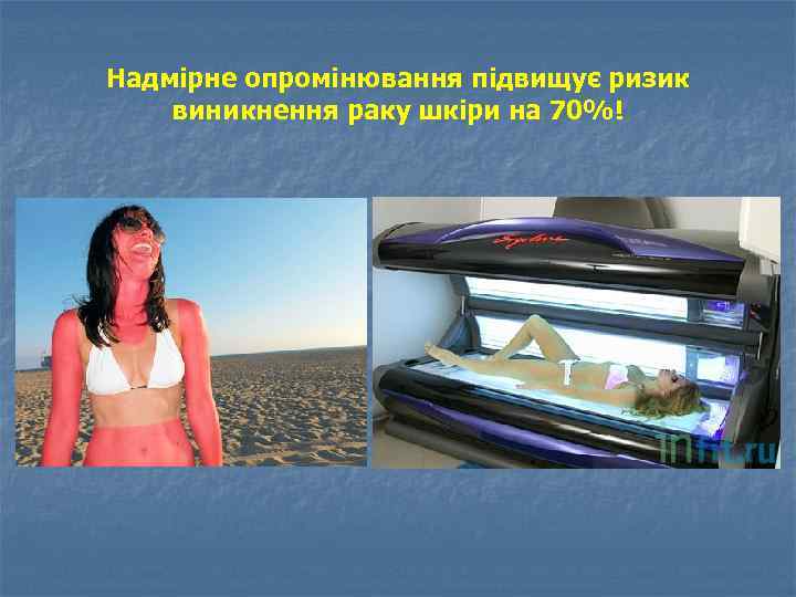 Надмірне опромінювання підвищує ризик виникнення раку шкіри на 70%! 