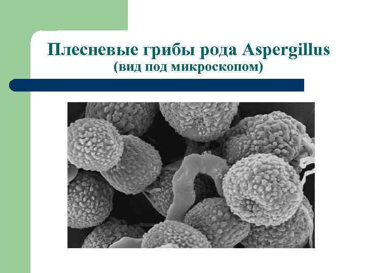 Плесневые грибы рода Аspergillus (вид под микроскопом) 
