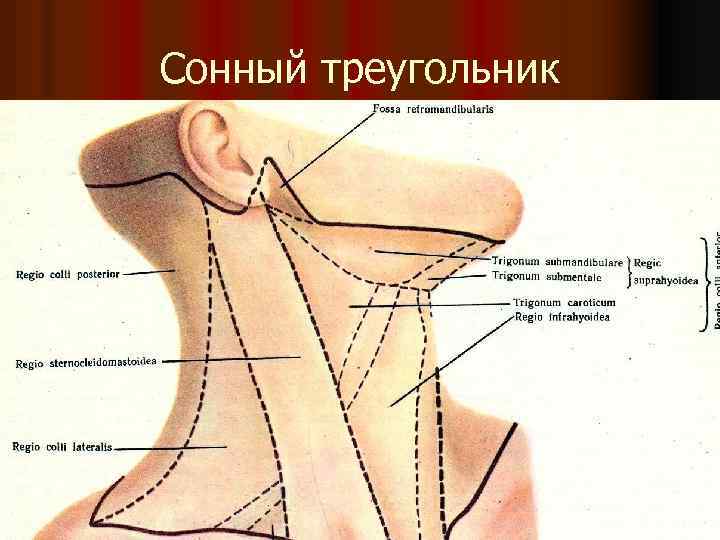 Сонный треугольник 