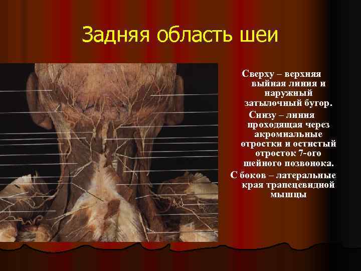 Задняя область шеи Сверху – верхняя выйная линия и наружный затылочный бугор. Снизу –