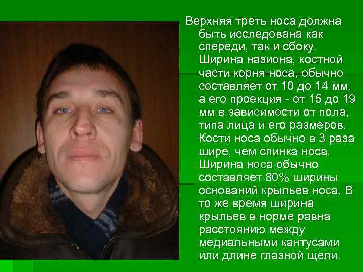 Верхняя треть носа должна быть исследована как спереди, так и сбоку. Ширина назиона, костной