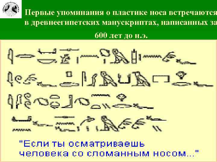 Первые упоминания о пластике носа встречаются в древнеегипетских манускриптах, написанных за 600 лет до