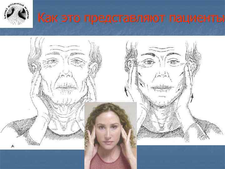 Как это представляют пациенты 