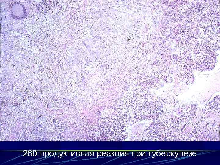 260 -продуктивная реакция при туберкулезе 