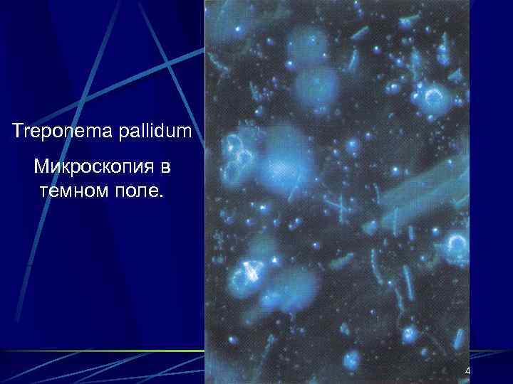 Treponema pallidum Микроскопия в темном поле. 4 