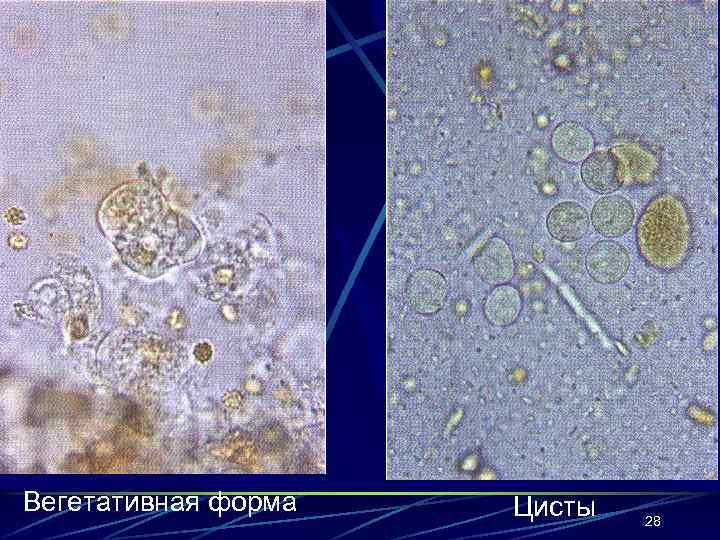 Вегетативная форма Цисты 28 