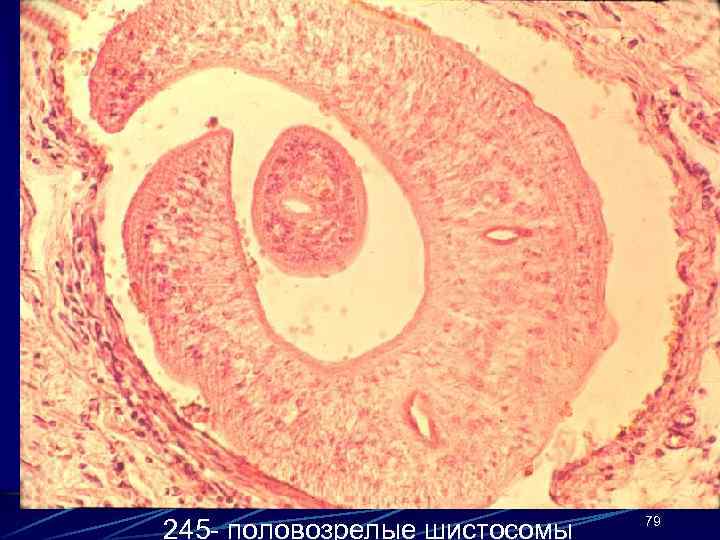 245 - половозрелые шистосомы 79 