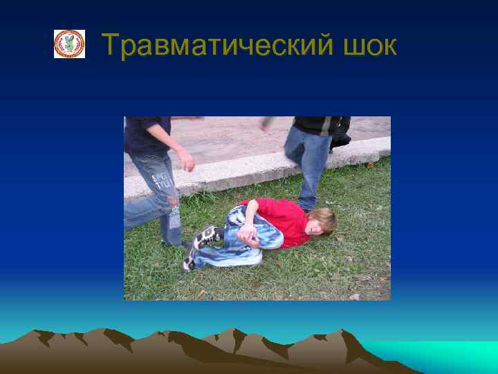 Травматический шок 