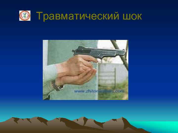 Травматический шок 
