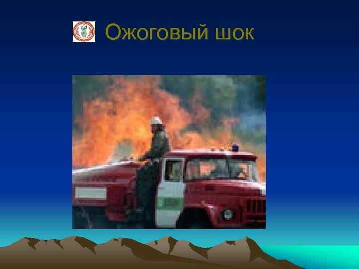 Ожоговый шок 