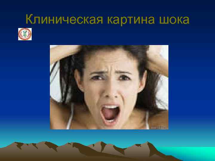 Клиническая картина шока 