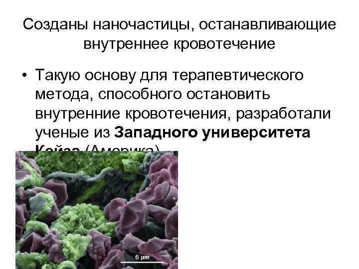 Созданы наночастицы, останавливающие внутреннее кровотечение • Такую основу для терапевтического метода, способного остановить внутренние