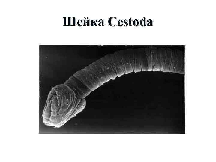 Шейка Cestoda 