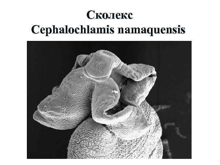 Сколекс Cephalochlamis namaquensis 