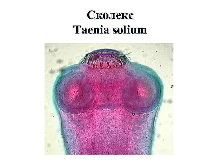 Сколекс Taenia solium 