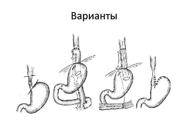 Варианты 