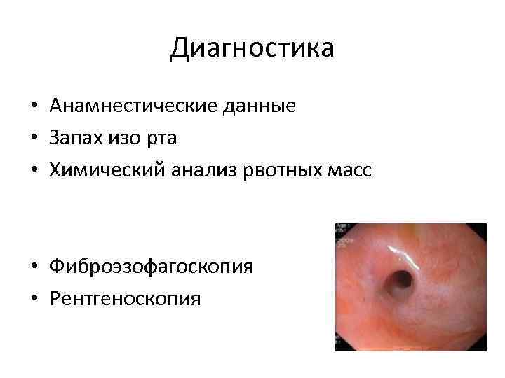 Диагностика • Анамнестические данные • Запах изо рта • Химический анализ рвотных масс •