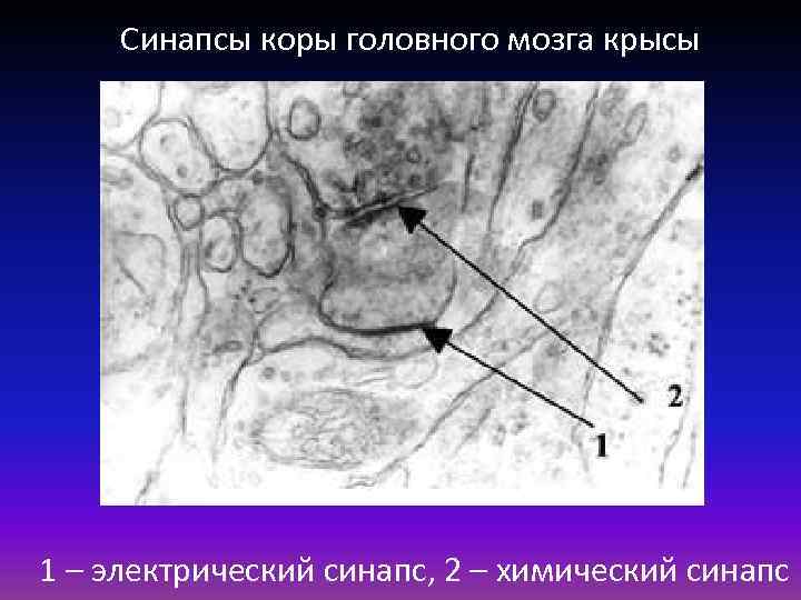 Синапсы коры головного мозга крысы 1 – электрический синапс, 2 – химический синапс 