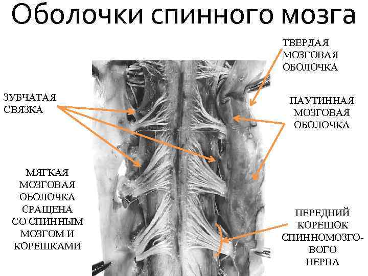 Оболочки спинного мозга ТВЕРДАЯ МОЗГОВАЯ ОБОЛОЧКА ЗУБЧАТАЯ СВЯЗКА МЯГКАЯ МОЗГОВАЯ ОБОЛОЧКА СРАЩЕНА СО СПИННЫМ