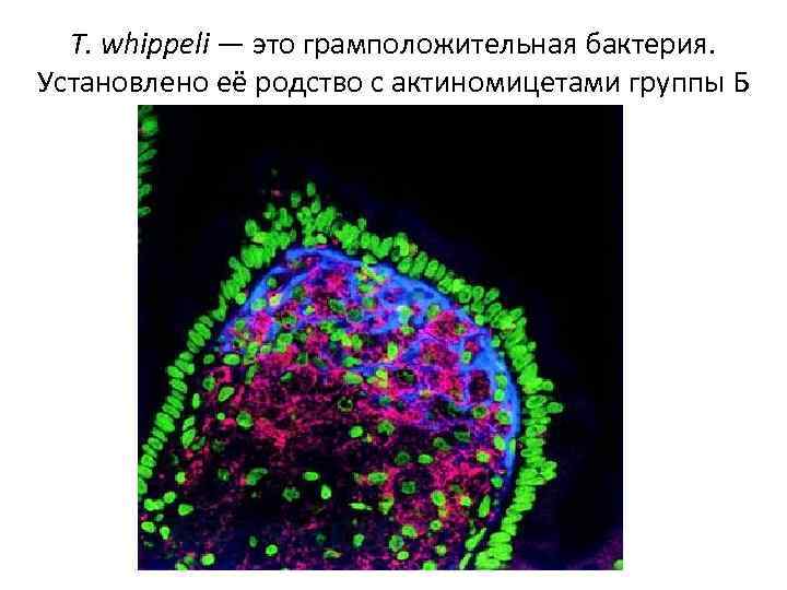 T. whippeli — это грамположительная бактерия. Установлено её родство с актиномицетами группы Б 
