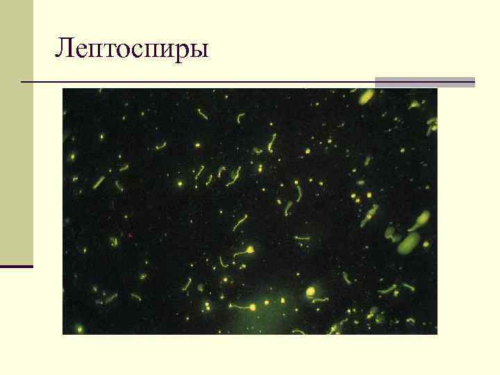 Лептоспиры 