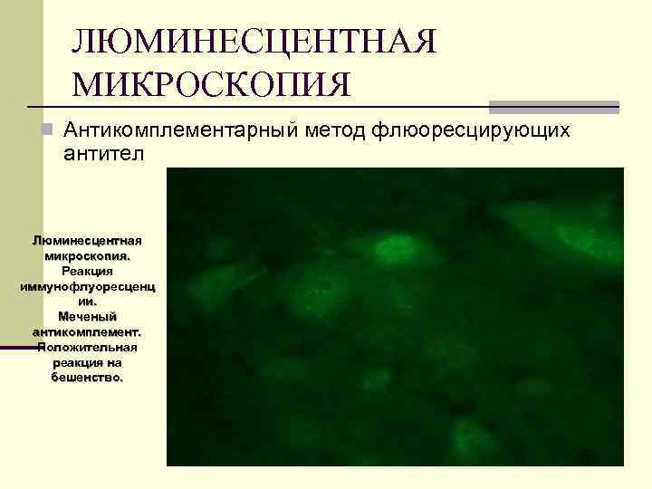 ЛЮМИНЕСЦЕНТНАЯ МИКРОСКОПИЯ n Антикомплементарный метод флюоресцирующих антител Люминесцентная микроскопия. Реакция иммунофлуоресценц ии. Меченый антикомплемент.