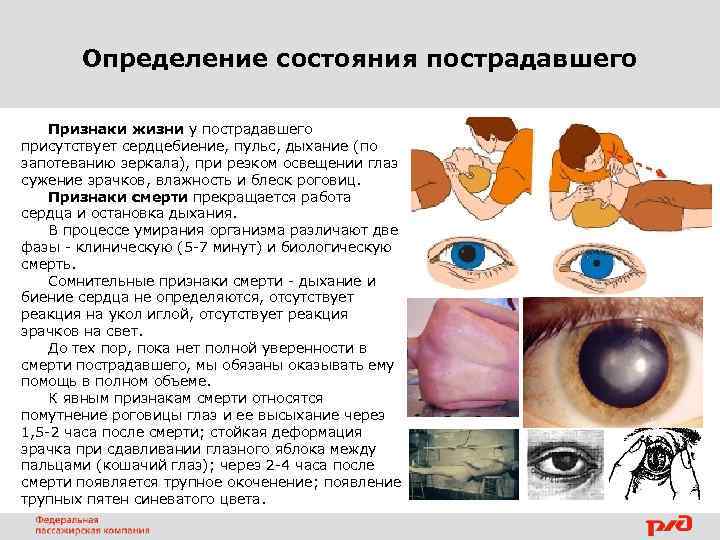Определение состояния пострадавшего Признаки жизни у пострадавшего присутствует сердцебиение, пульс, дыхание (по запотеванию зеркала),