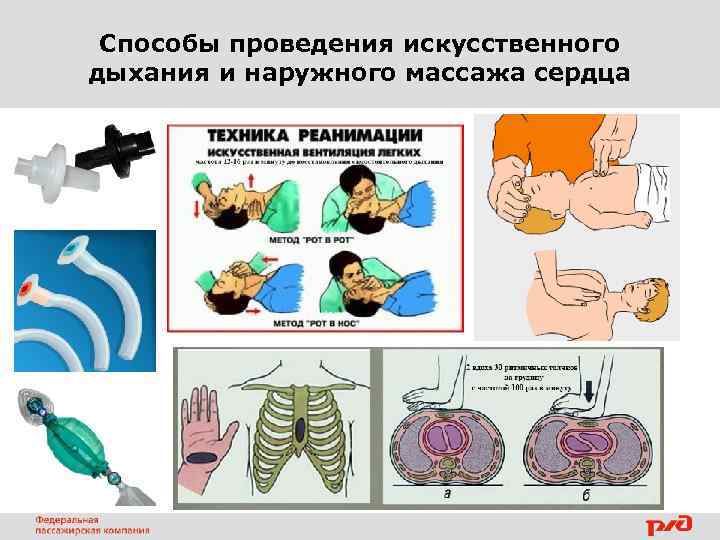 Способы проведения искусственного дыхания и наружного массажа сердца 