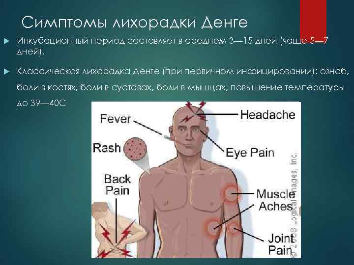 Симптомы лихорадки Денге Инкубационный период составляет в среднем 3— 15 дней (чаще 5— 7