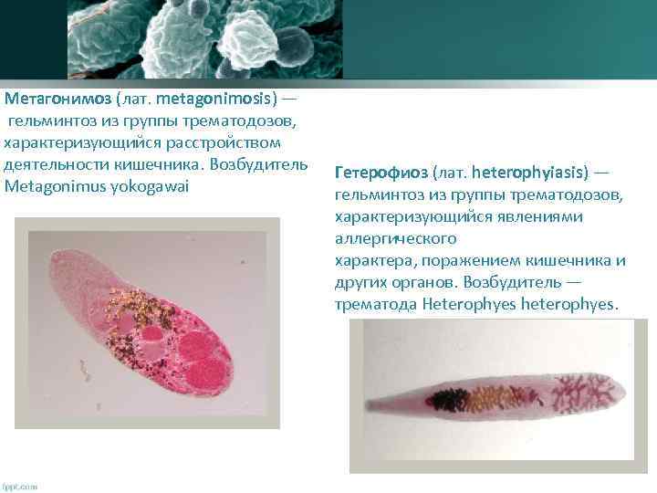 Метагонимоз (лат. metagonimosis) — гельминтоз из группы трематодозов, характеризующийся расстройством деятельности кишечника. Возбудитель Metagonimus