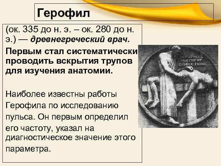 Герофил (ок. 335 до н. э. – ок. 280 до н. э. ) —