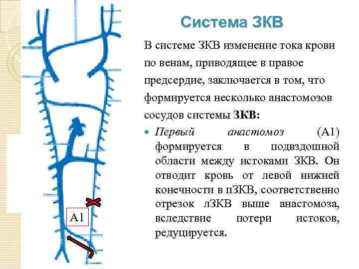 Система ЗКВ А 1 В системе ЗКВ изменение тока крови по венам, приводящее в