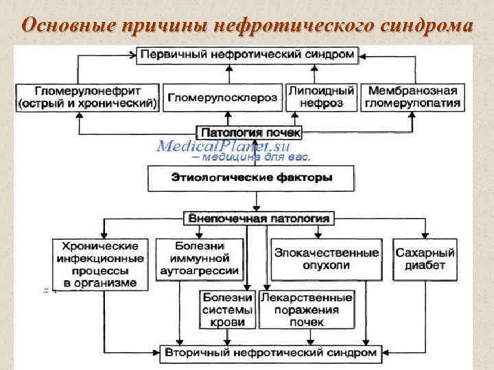 Основные причины нефротического синдрома 