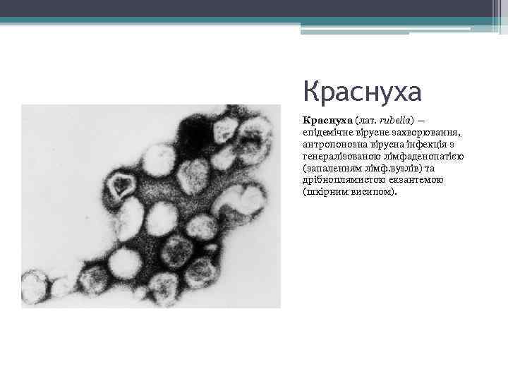 Краснуха (лат. rubella) — епідемічне вірусне захворювання, антропонозна вірусна інфекція з генералізованою лімфаденопатією (запаленням