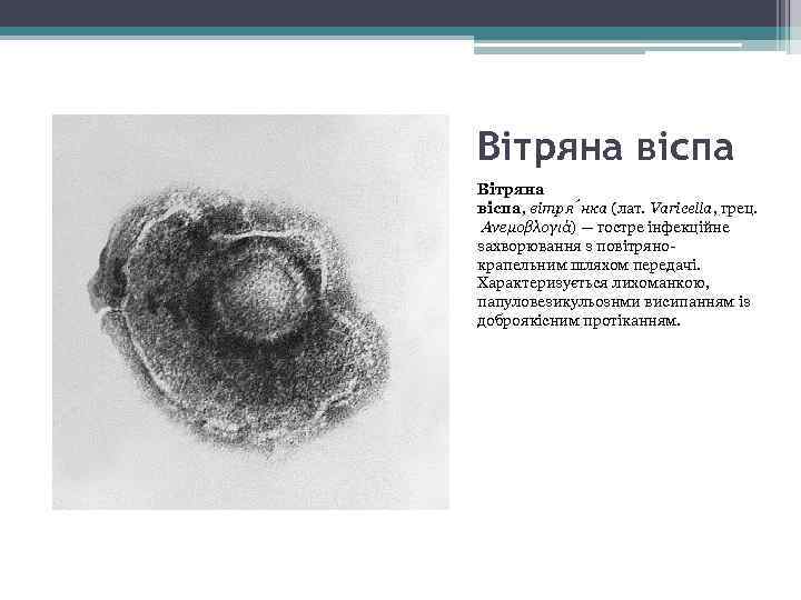 Вітряна віспа, вітря нка (лат. Varicella, грец. Ανεμοβλογιά) — гостре інфекційне захворювання з повітрянокрапельним