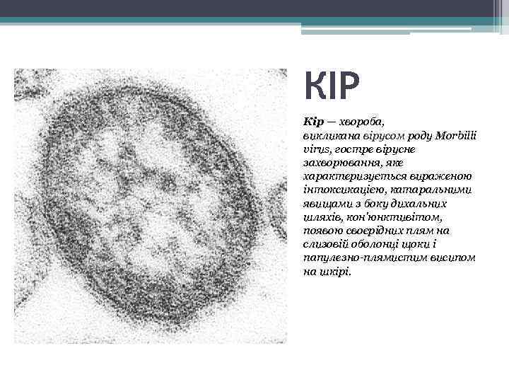 КІР Кір — хвороба, викликана вірусом роду Morbillі virus, гостре вірусне захворювання, яке характеризується