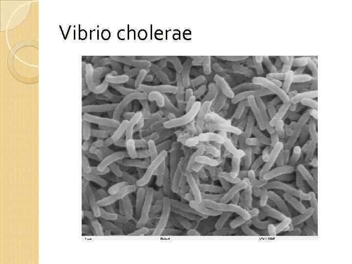 Vibrio cholerae 
