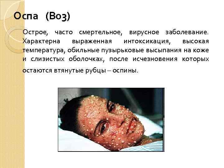 Оспа (В 03) Острое, часто смертельное, вирусное заболевание. Характерна выраженная интоксикация, высокая температура, обильные
