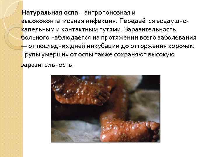 Натуральная оспа – антропонозная и высококонтагиозная инфекция. Передаётся воздушнокапельным и контактным путями. Заразительность больного
