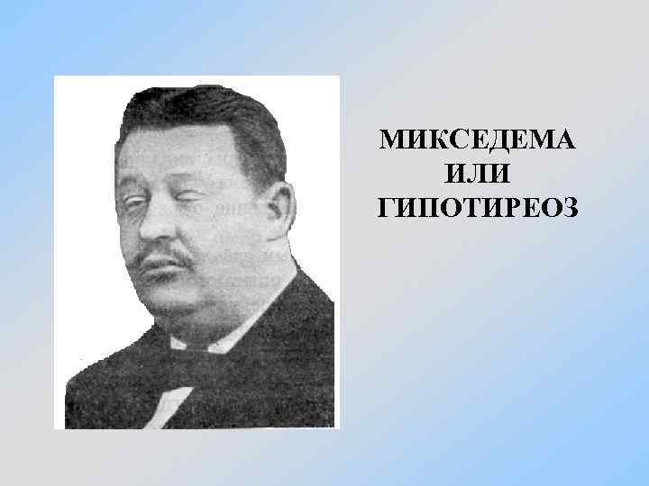 МИКСЕДЕМА ИЛИ ГИПОТИРЕОЗ 