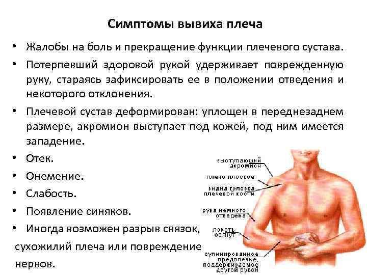 Симптомы вывиха плеча • Жалобы на боль и прекращение функции плечевого сустава. • Потерпевший