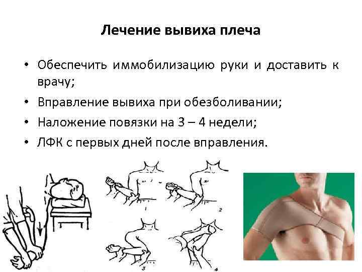 Лечение вывиха плеча • Обеспечить иммобилизацию руки и доставить к врачу; • Вправление вывиха