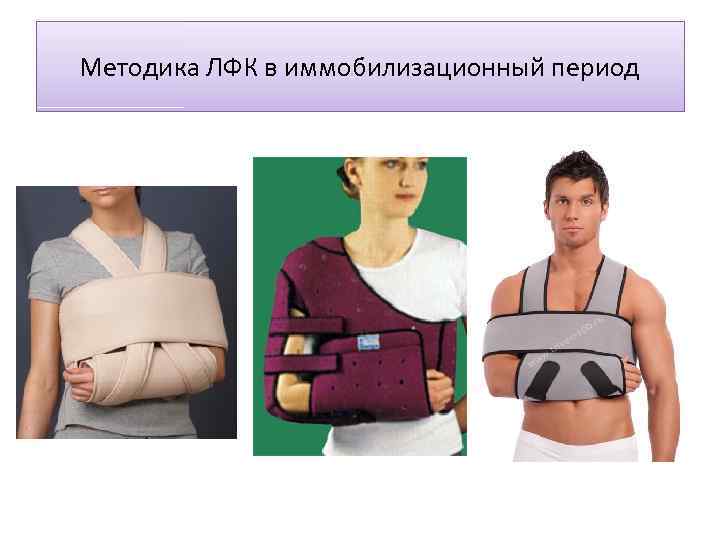 Методика ЛФК в иммобилизационный период 