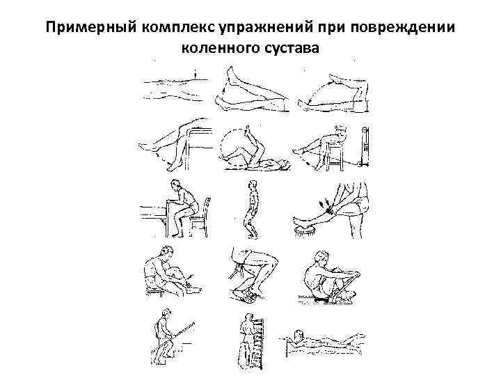 Примерный комплекс упражнений при повреждении коленного сустава 