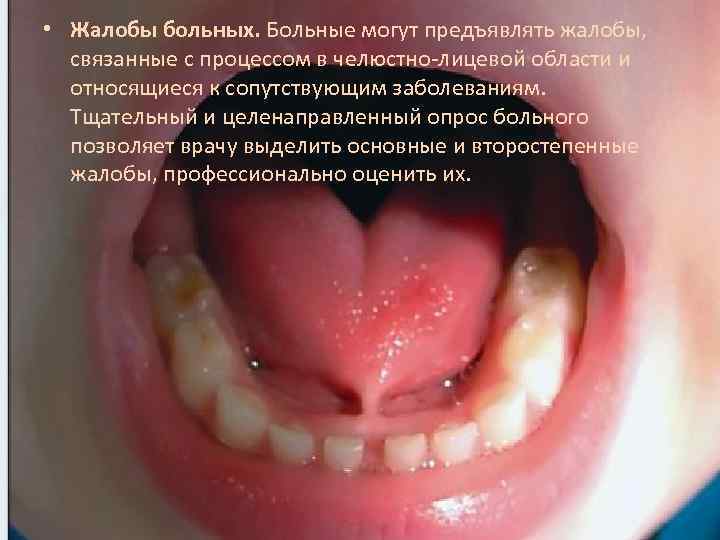  • Жалобы больных. Больные могут предъявлять жалобы, связанные с процессом в челюстно-лицевой области