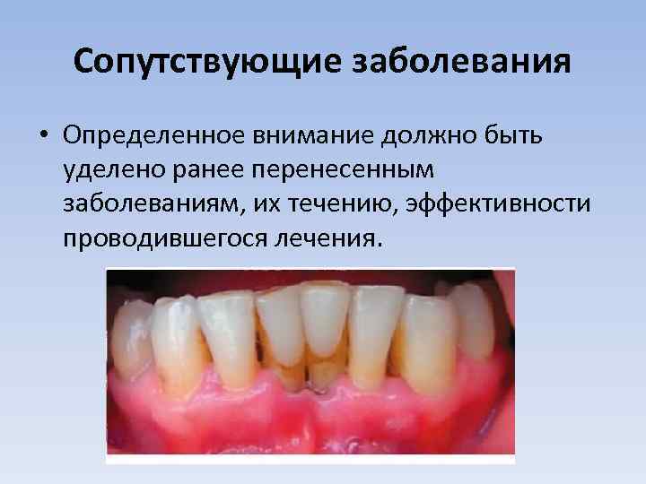 Сопутствующие заболевания • Определенное внимание должно быть уделено ранее перенесенным заболеваниям, их течению, эффективности