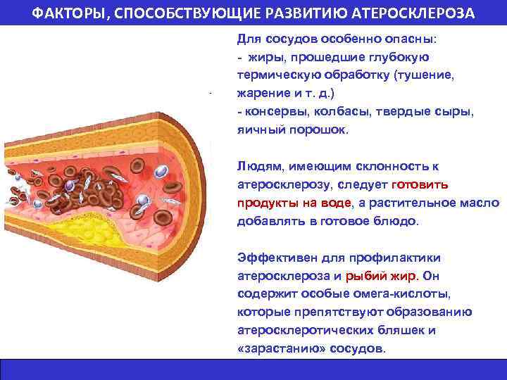 ФАКТОРЫ, СПОСОБСТВУЮЩИЕ РАЗВИТИЮ АТЕРОСКЛЕРОЗА Для сосудов особенно опасны: - жиры, прошедшие глубокую термическую обработку